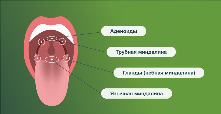 Анатомия горла: расположение миндалин 