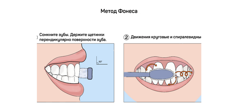 Метод Фонеса