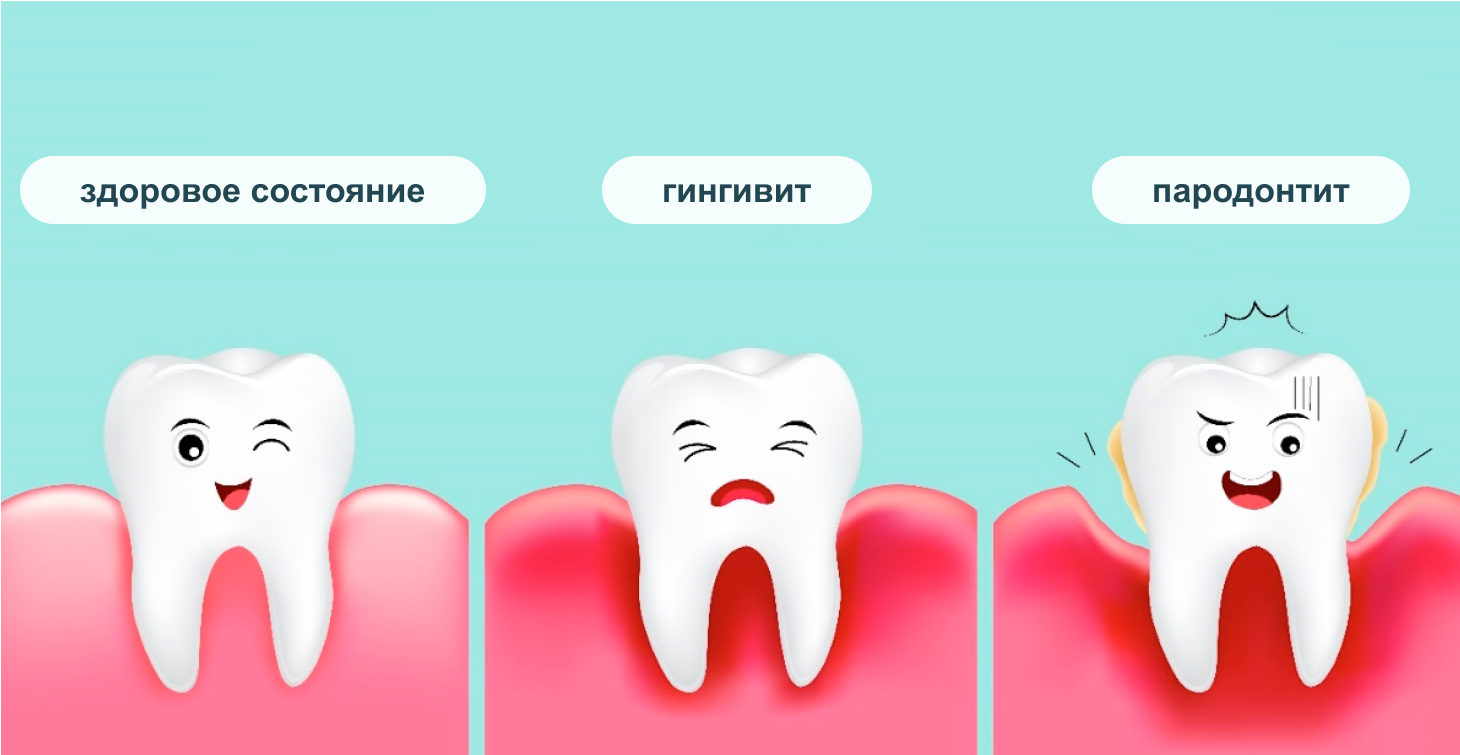 Прогнозирование и профилактика язвенно-некротического