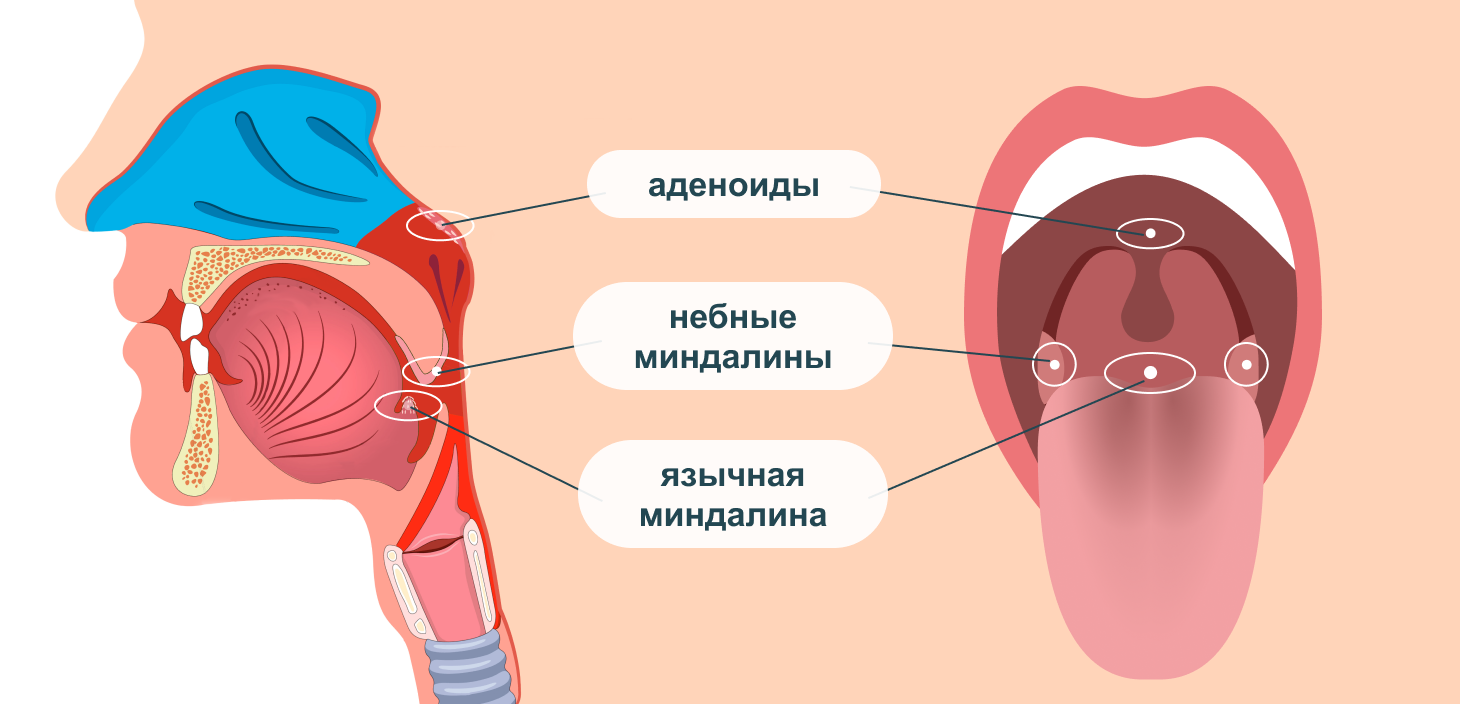  Где находятся миндалины и аденоиды